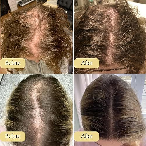 Botany & Co Hair Growth Serum – Reduce Hair Loss & Boost Regrowth