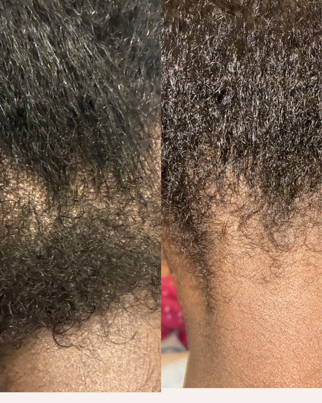 Botany & Cosmetics The Resilience Serum Hair Growth