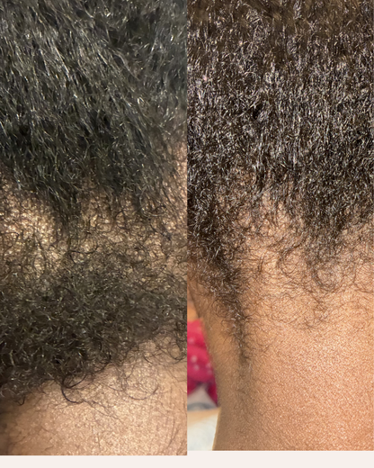 Botany & Cosmetics The Resilience Serum Hair Growth