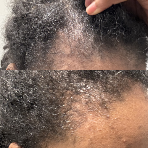 Botany & Cosmetics The Resilience Serum Hair Growth